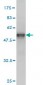 TRAPPC4 Antibody (monoclonal) (M01)
